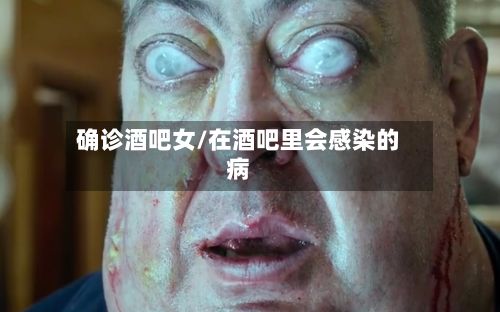 确诊酒吧女/在酒吧里会感染的病
