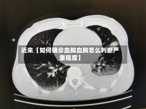 近来【如何确诊血胸血胸怎么判断严重程度】-第2张图片