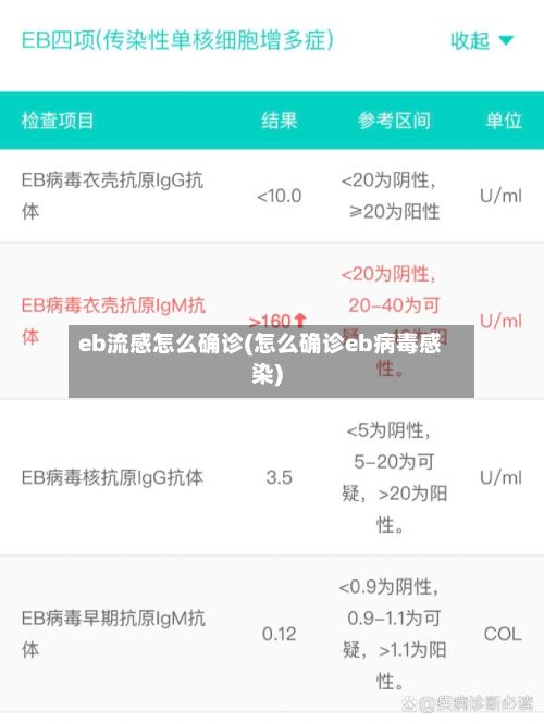 eb流感怎么确诊(怎么确诊eb病毒感染)-第2张图片